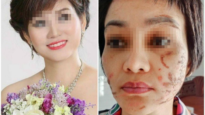 YouTuber, TikToker vay nha nguoi chong bao hanh vo mang thai hinh anh