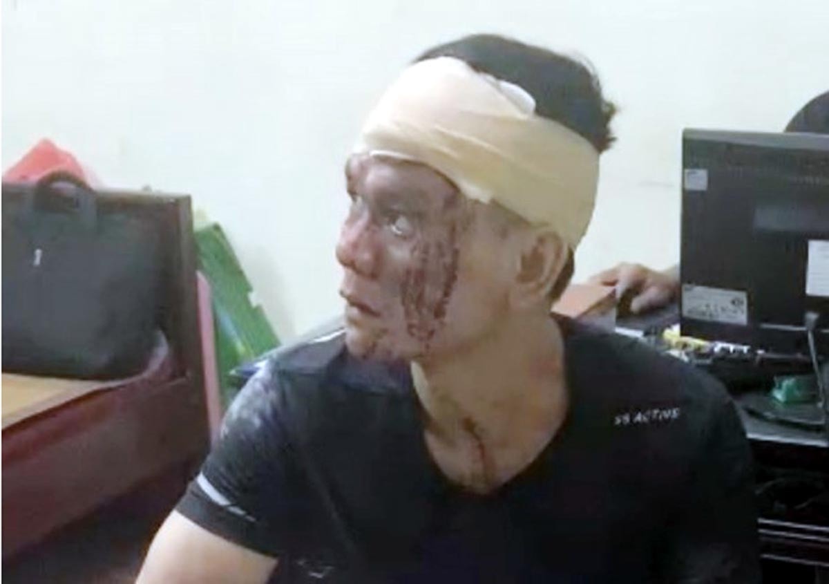 Mau thuan nho nhat, thanh nien dam 3 nguoi hinh anh