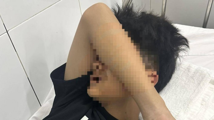 Dieu tra vu thieu nien 14 tuoi o Da Nang bi danh khi tam bien hinh anh