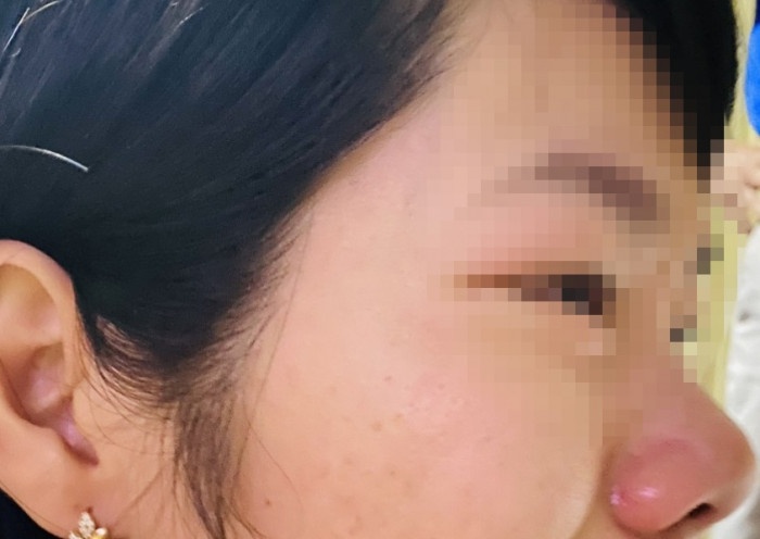 Con bi hanh kiem trung binh, phu huynh den nha hanh hung co giao hinh anh