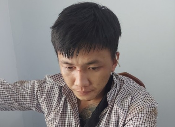 Tam giu thanh nien cuop giat tai san lam nguoi phu nu te xuong duong hinh anh