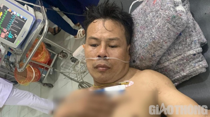 giet nguoi tinh anh 1