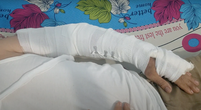 chem nhap vien anh 2