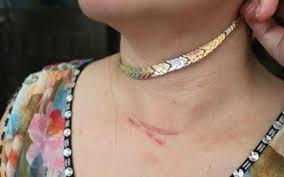 Nam thanh nien cuop day chuyen vang 10 chi tren co nguoi phu nu hinh anh