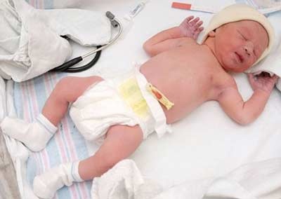 Bang ron hay khong bang ron tre so sinh? hinh anh