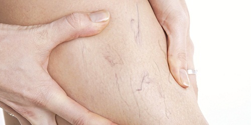 Suy tinh mach chan anh 1