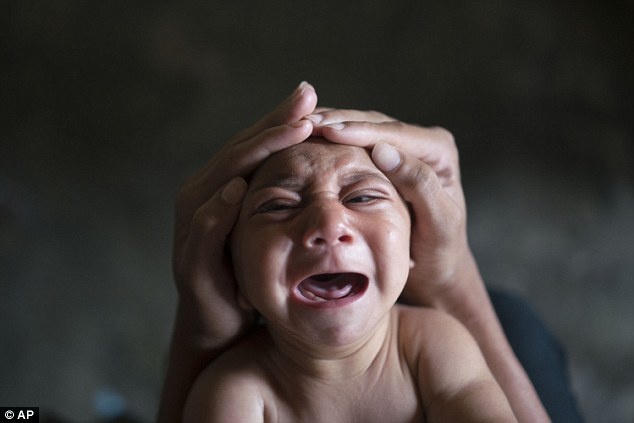 'Virus Zika se lan rong toan chau Au mua he nay' hinh anh