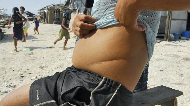 Điều gì xảy ra khi hiến tặng nội tạng ảnh 1 Dieu gi xay ra khi hien tang noi tang anh 1