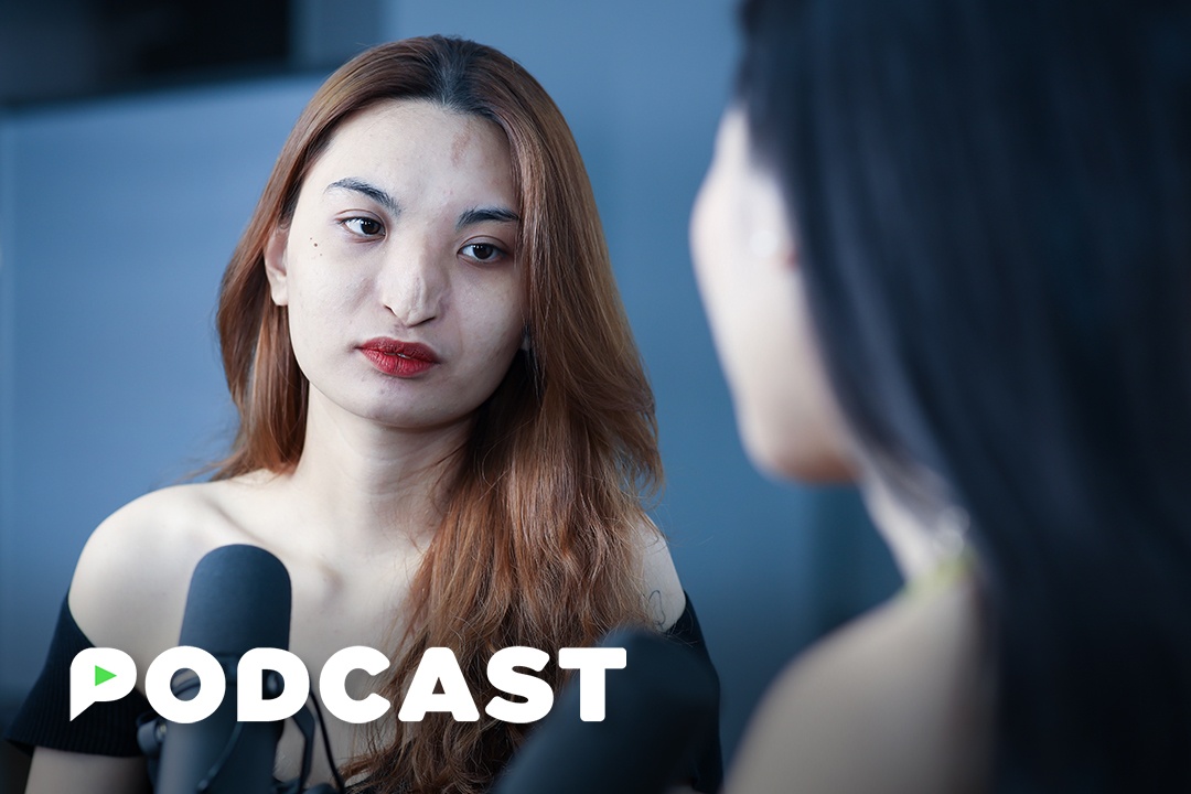 Ve dep lech chuan cua nguoi mau co mui khong xuong hinh anh