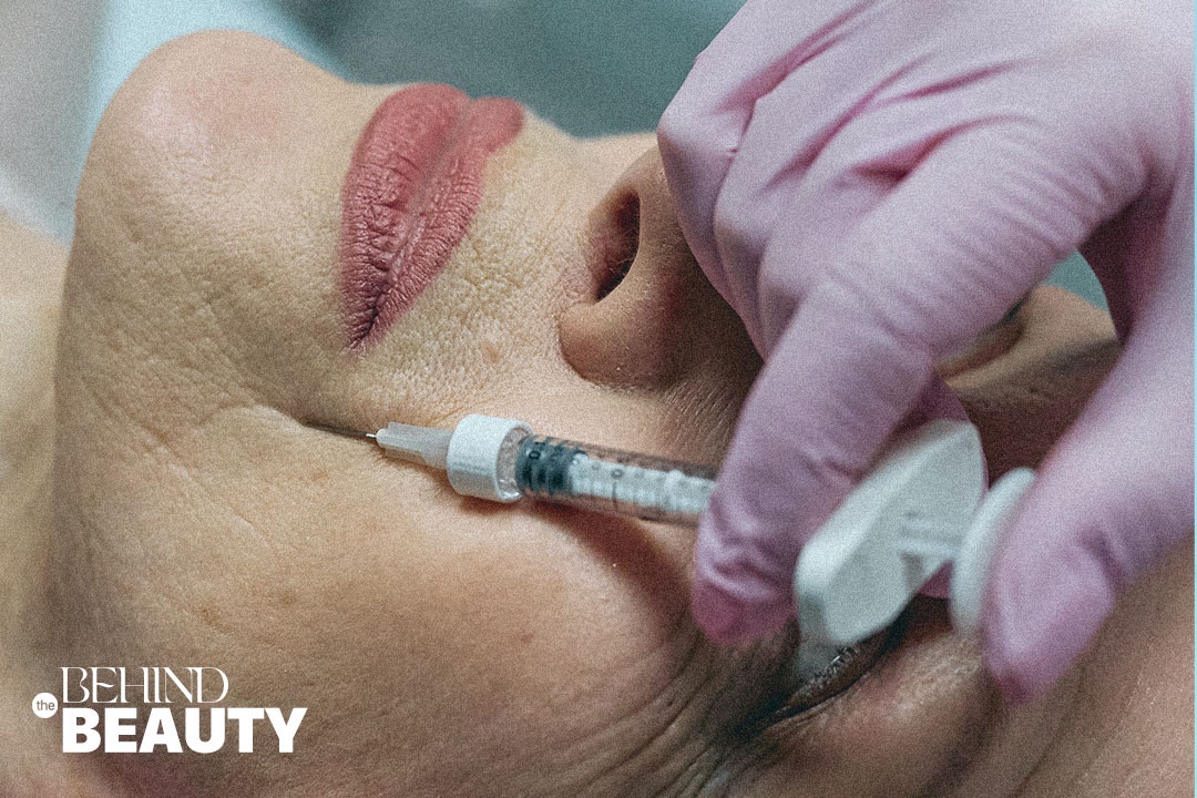 Su that ve tiem filler hinh anh