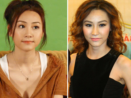 Can canh nhan sac sao Viet sau phau thuat tham my hinh anh