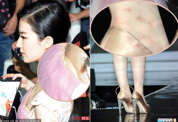 Luu Diec Phi ho noi y va lo co the day mun hinh anh