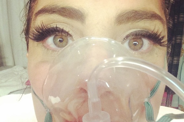 Lady Gaga nhap vien cung 'tu suong' hinh anh