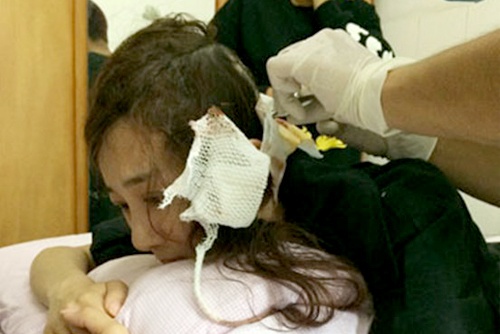 Sao Hoa ngu bi khau hon 20 mui vi tai nan tren phim truong hinh anh