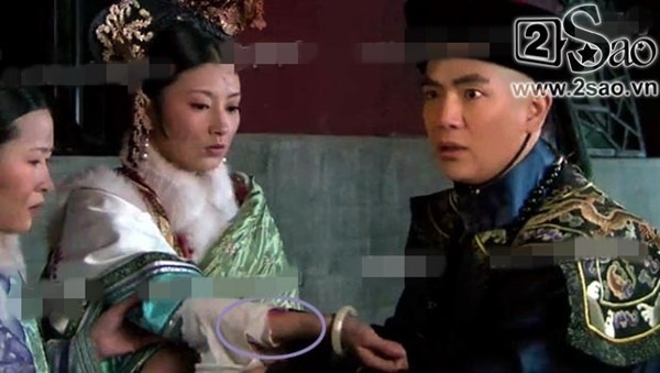 Thế nhưng tích tắc sau, vết thương lại lộ ra.