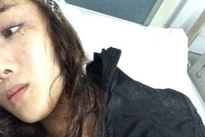 Sao Hoa ngu bi cho cua Diep Tuyen can khau hon 20 mui hinh anh