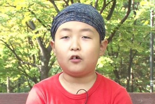 'Psy nhi' Trung Quoc bi u nao, chi song duoc 6 thang hinh anh