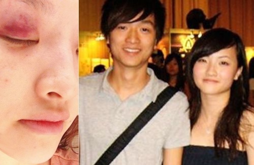 Ca si Hong Kong bi ban trai danh vi nghi phan boi hinh anh