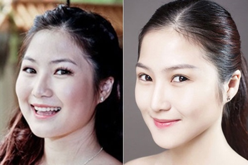 Than hinh gay, beo that thuong cua Huong Tram hinh anh