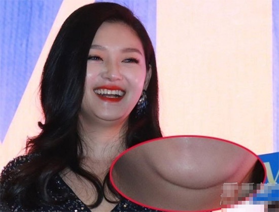 Từ Hy Viên lộ gương mặt tròn và hai cằm bóng loáng.