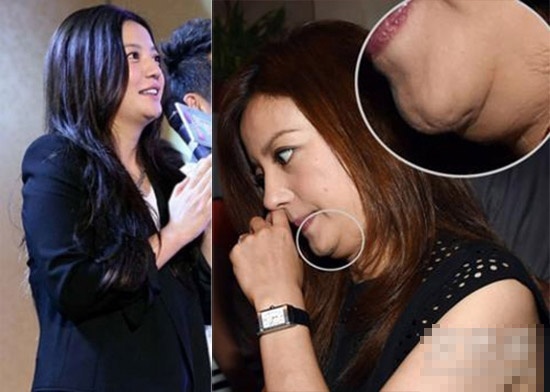 Loat sao nu mat diem vi cam mo thua hinh anh