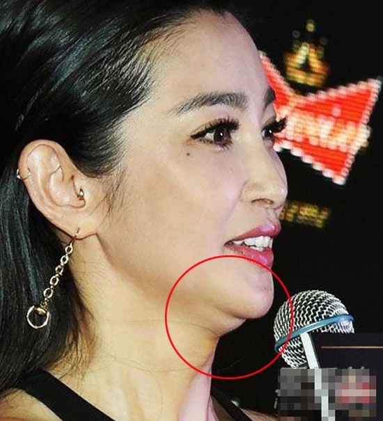 Lý Băng Băng cho thấy nhan sắc đang ngày một đi xuống vì hai cằm.