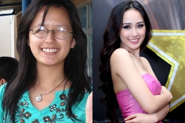 Mai Phương Thúy thời chưa đăng quang với làn da mụn và mắt cận