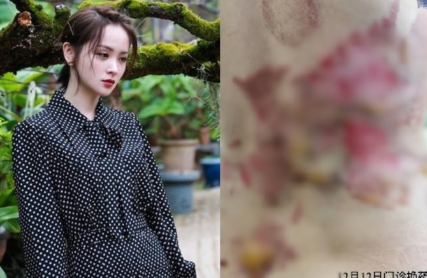 Nguoi dep Trung Quoc bong nang sau khi giac hoi hinh anh