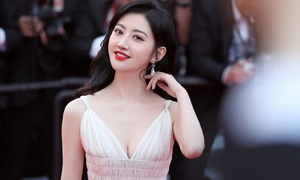 Canh Diem tung gap bien chung sau phau thuat cat mi mat hinh anh