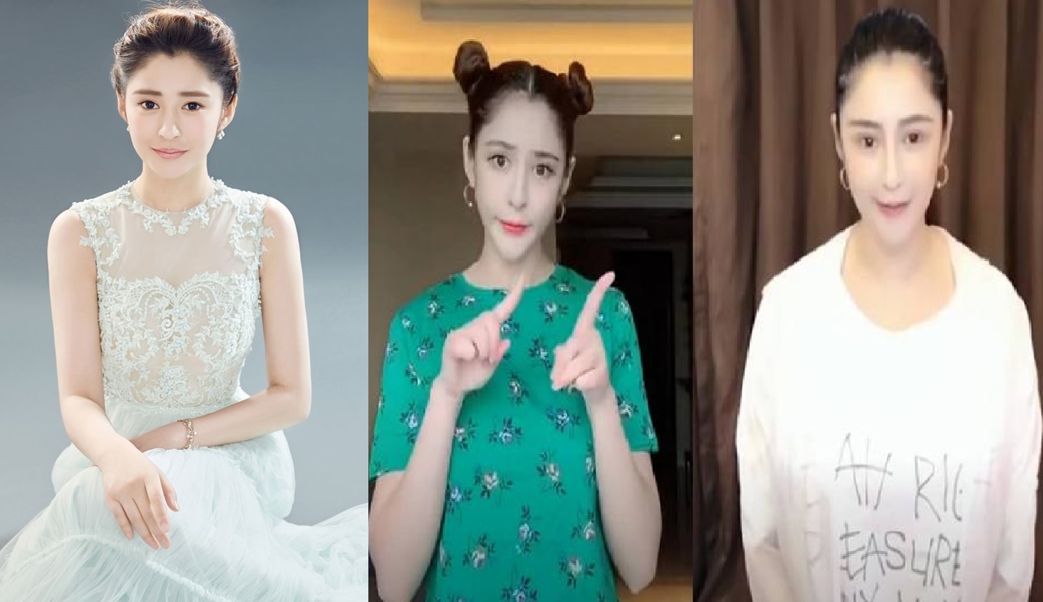 Ly Tam Ngai phau thuat tham my anh 2