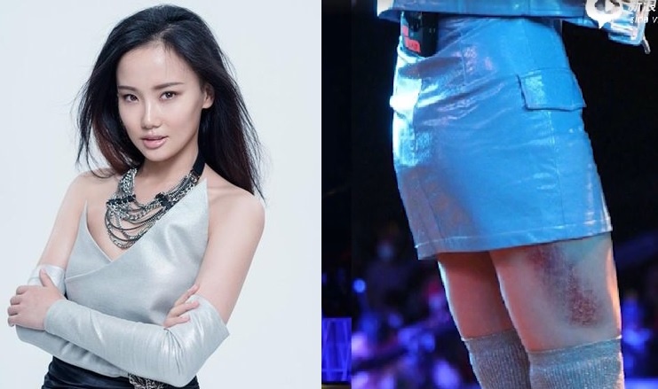 Hoang Linh bi te nga anh 2