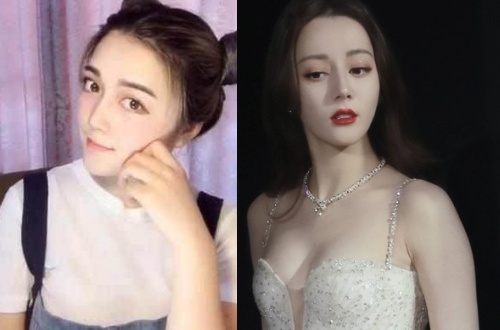 Mat trai ve phau thuat tham my o showbiz Trung Quoc hinh anh