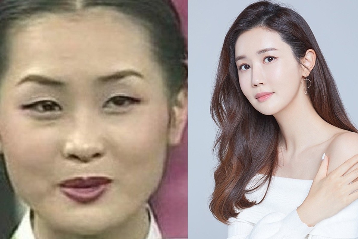 Am anh ngoai hinh day nghe si nu chau A vao cuoc dua ‘dao keo’ hinh anh
