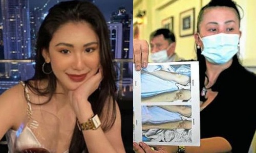 Vu nguoi dep Philippines tu vong: Ket qua kham nghiem co su khac biet hinh anh