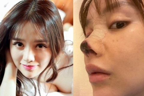 Nu dien vien Trung Quoc muon tu sat sau khi tham my hong hinh anh