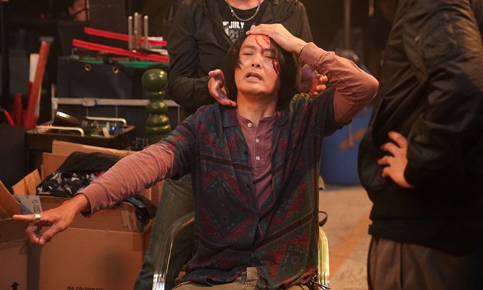 Sao bi thuong tren phim truong anh 6