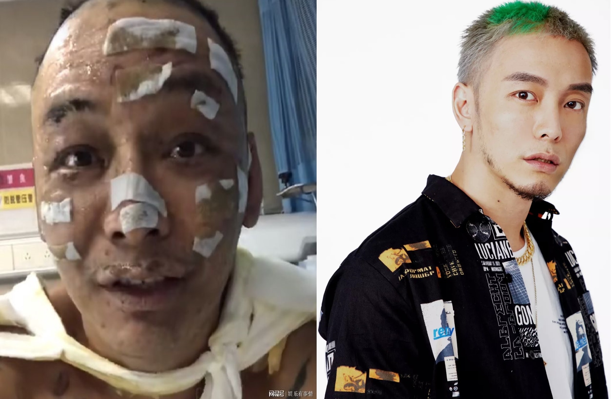 Nam rapper Trung Quoc bi bong nang sau vu chay nha hinh anh