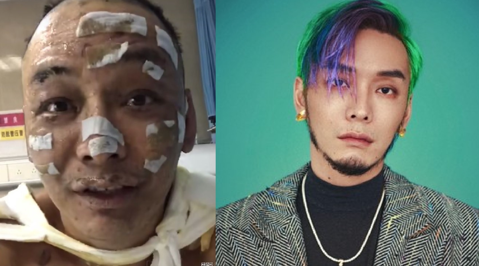 Rapper Trung Quoc bi bong anh 1