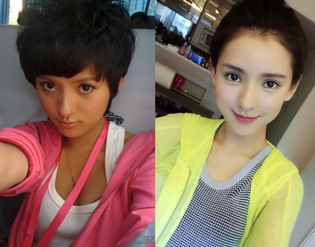 Truong Du Hi phau thuat tham my anh 1