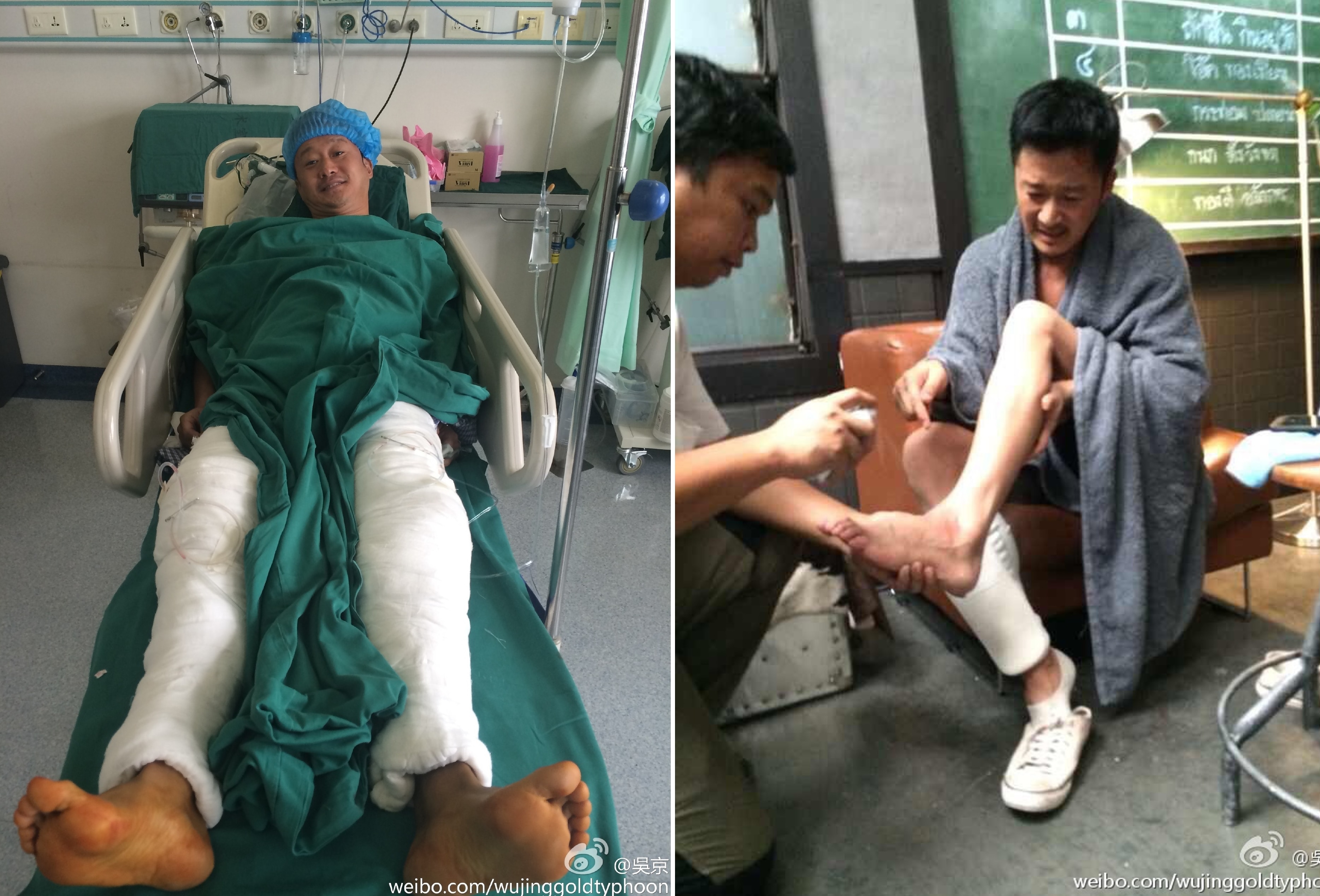 Ngo Kinh va nhung chan thuong tan pha co the anh 2