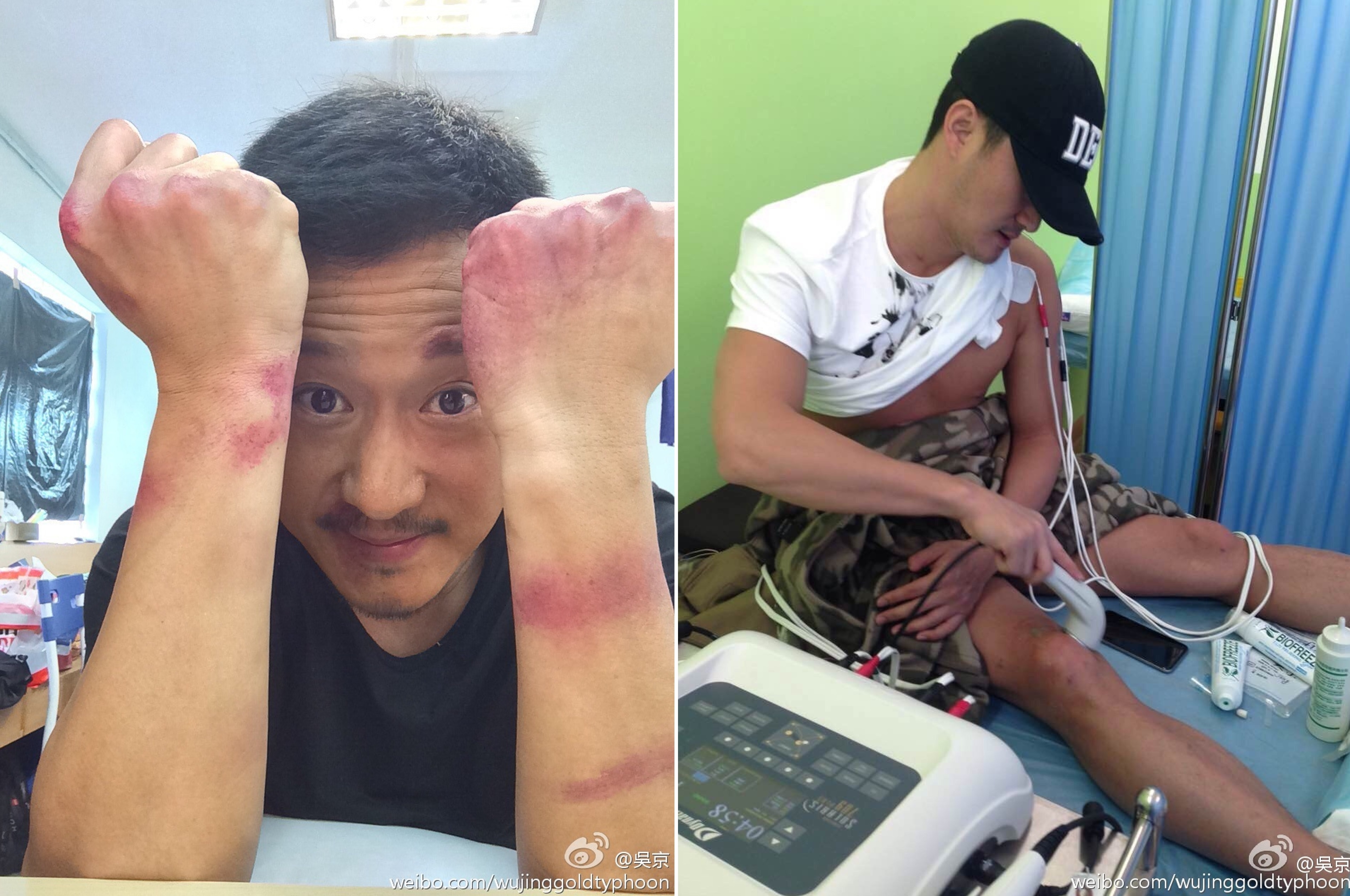 Ngo Kinh va nhung chan thuong tan pha co the anh 3