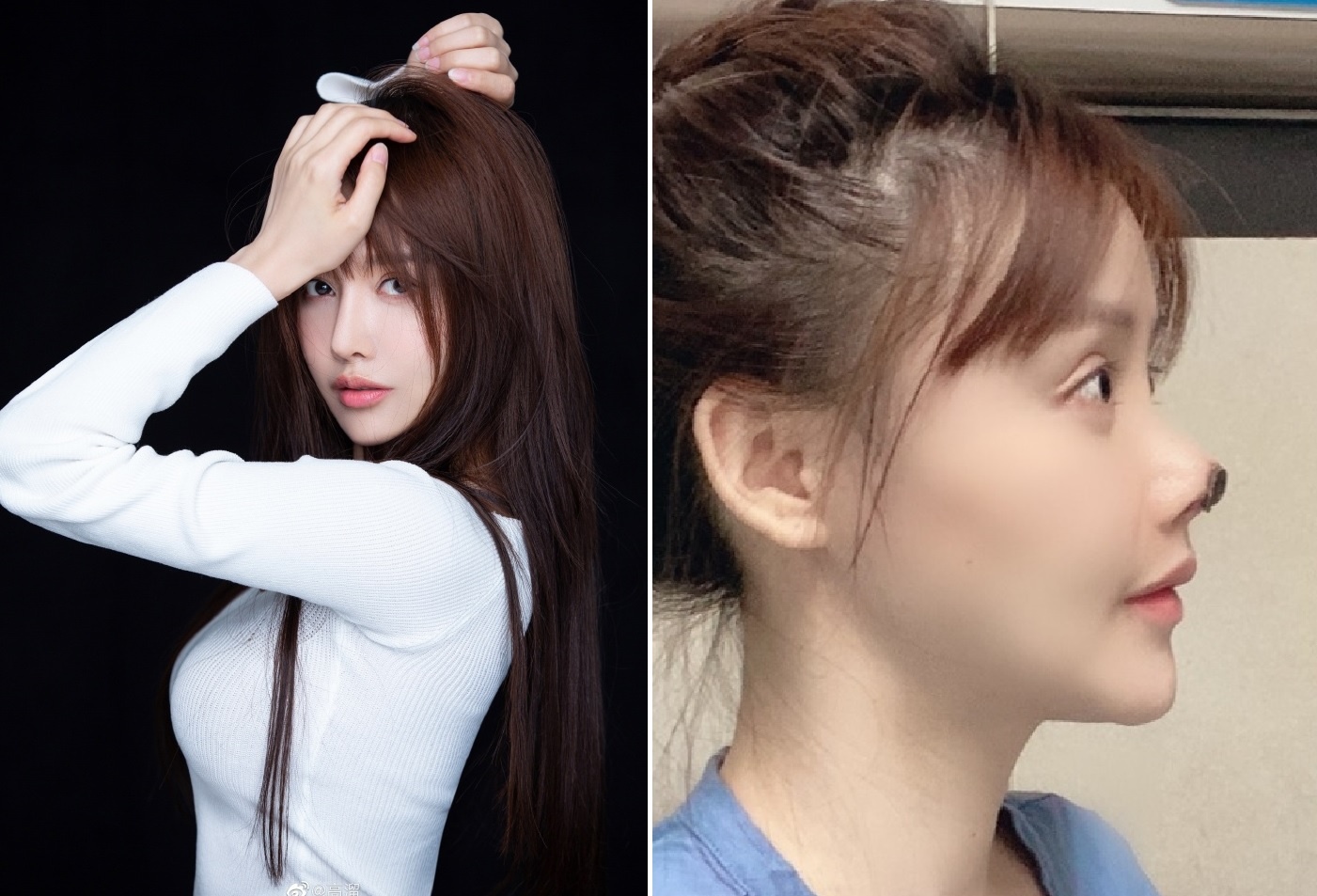 Bi kich phau thuat tham my cua sao Hoa ngu anh 2