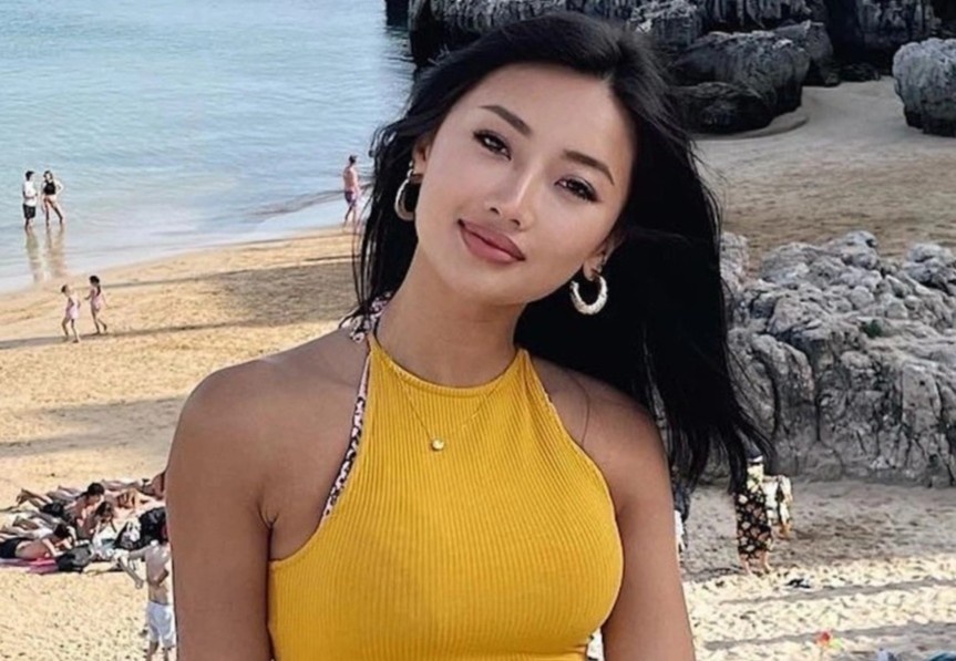 Nguoi dep Hoa hau Hong Kong gay chu y voi vet seo dai 30 cm tren bung hinh anh