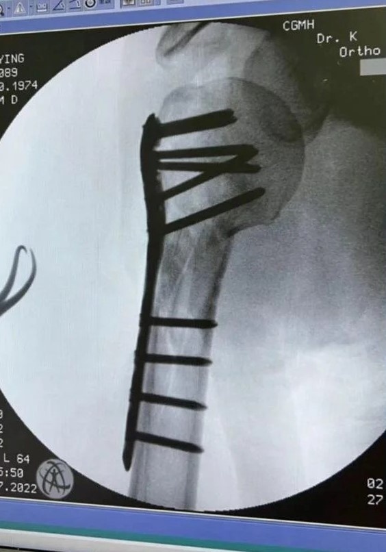 Lam Chi Dinh tai nan anh 2