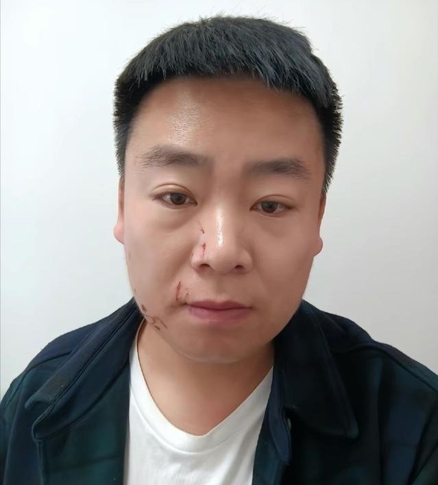 Dich Le Nhiet Ba anh 1