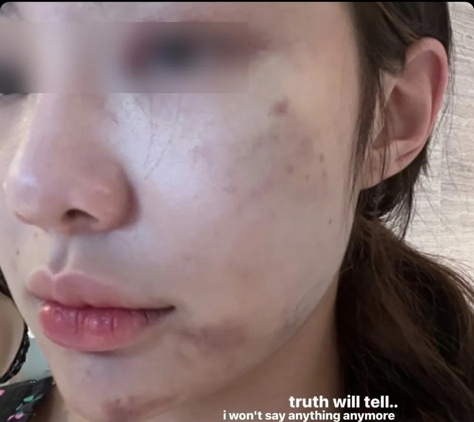 Gigi Supitcha qua đời ảnh 3 Gigi Supitcha qua doi anh 3