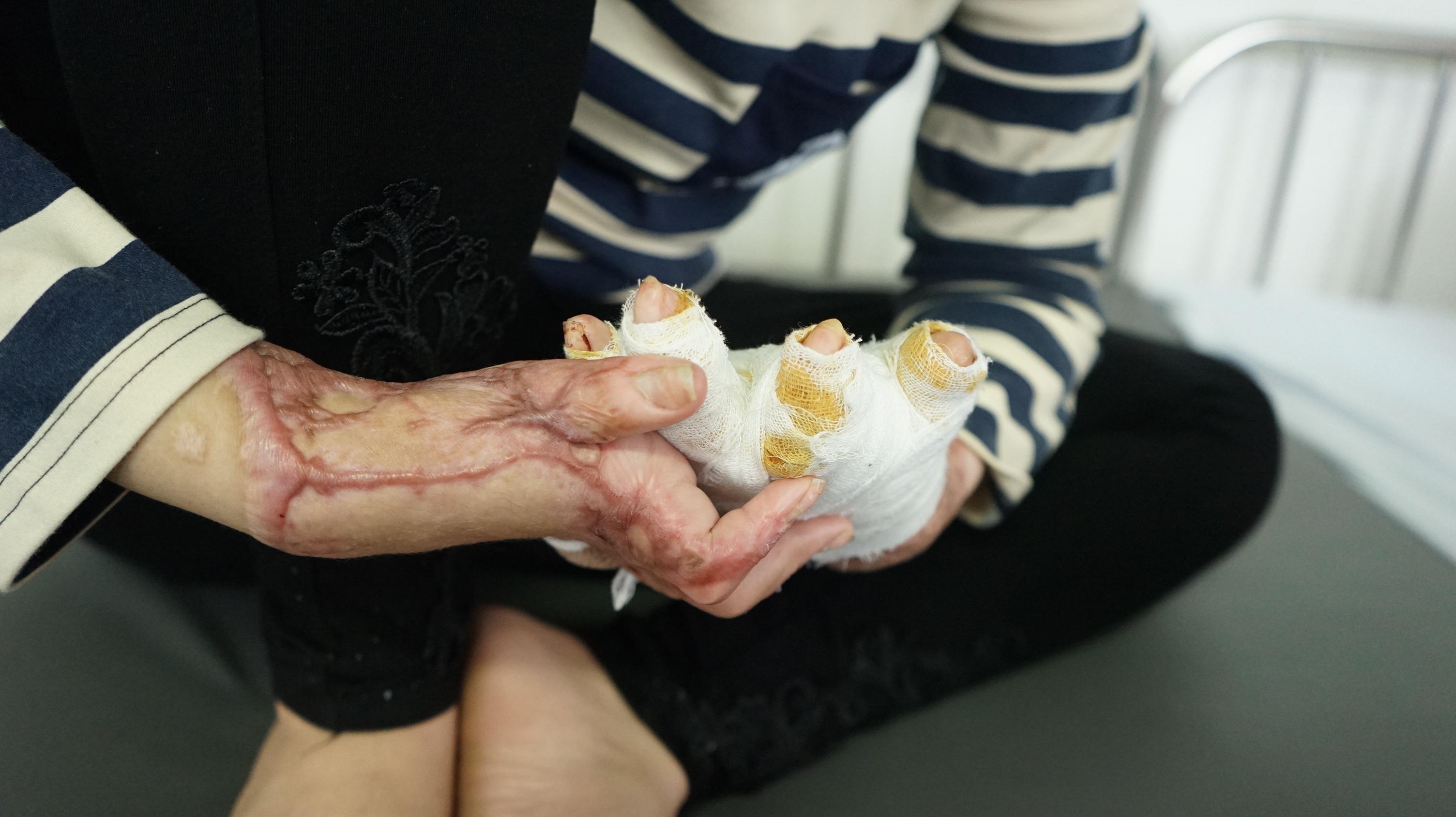 Co gai bi chong tuoi xang dot anh 11