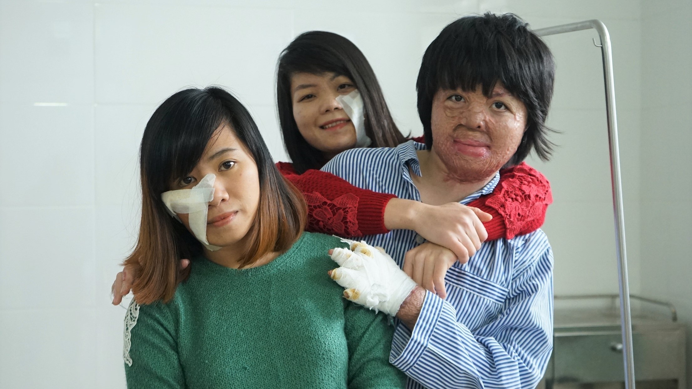 Co gai bi chong tuoi xang dot anh 14