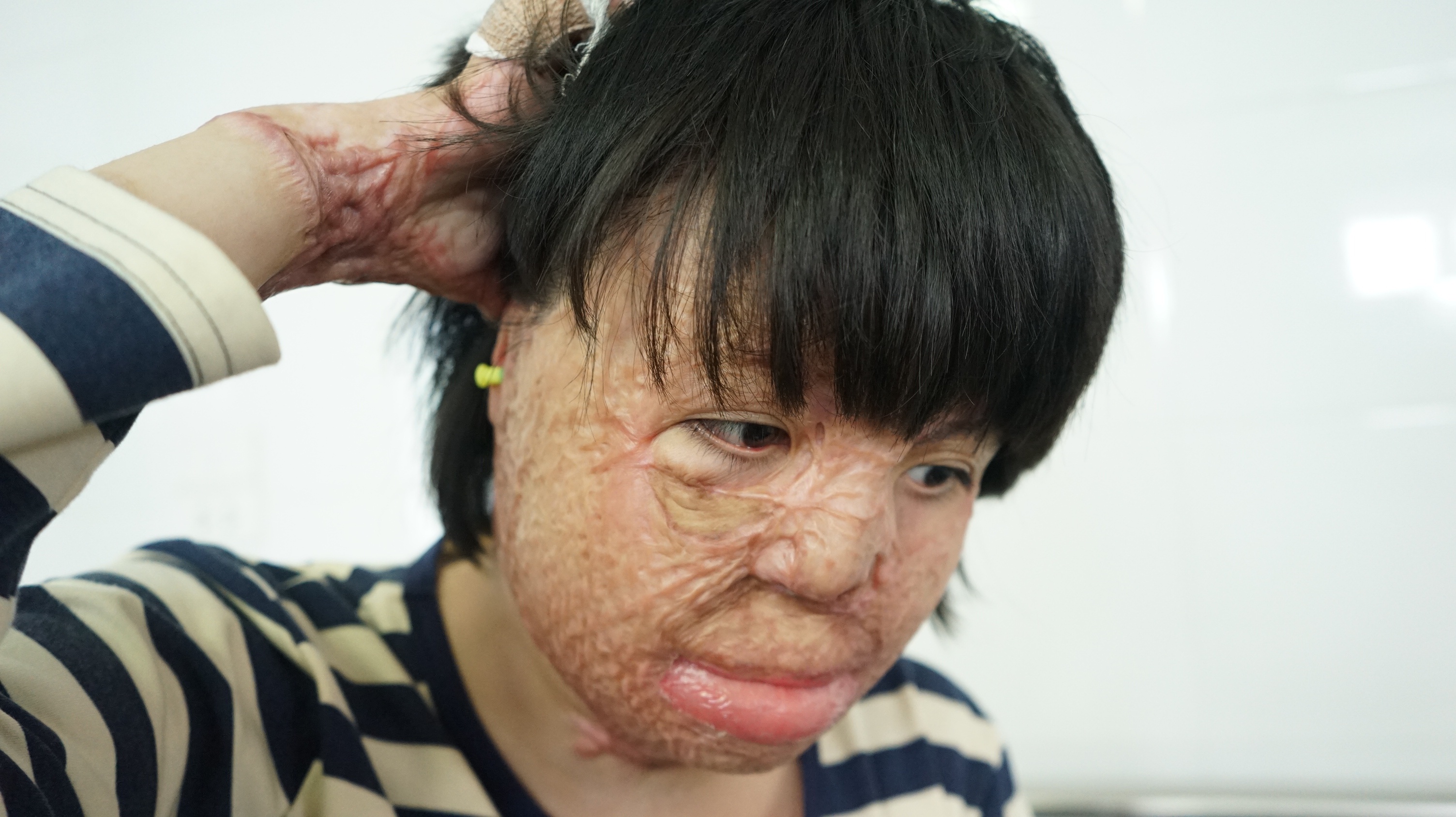 Co gai bi chong tuoi xang dot anh 2