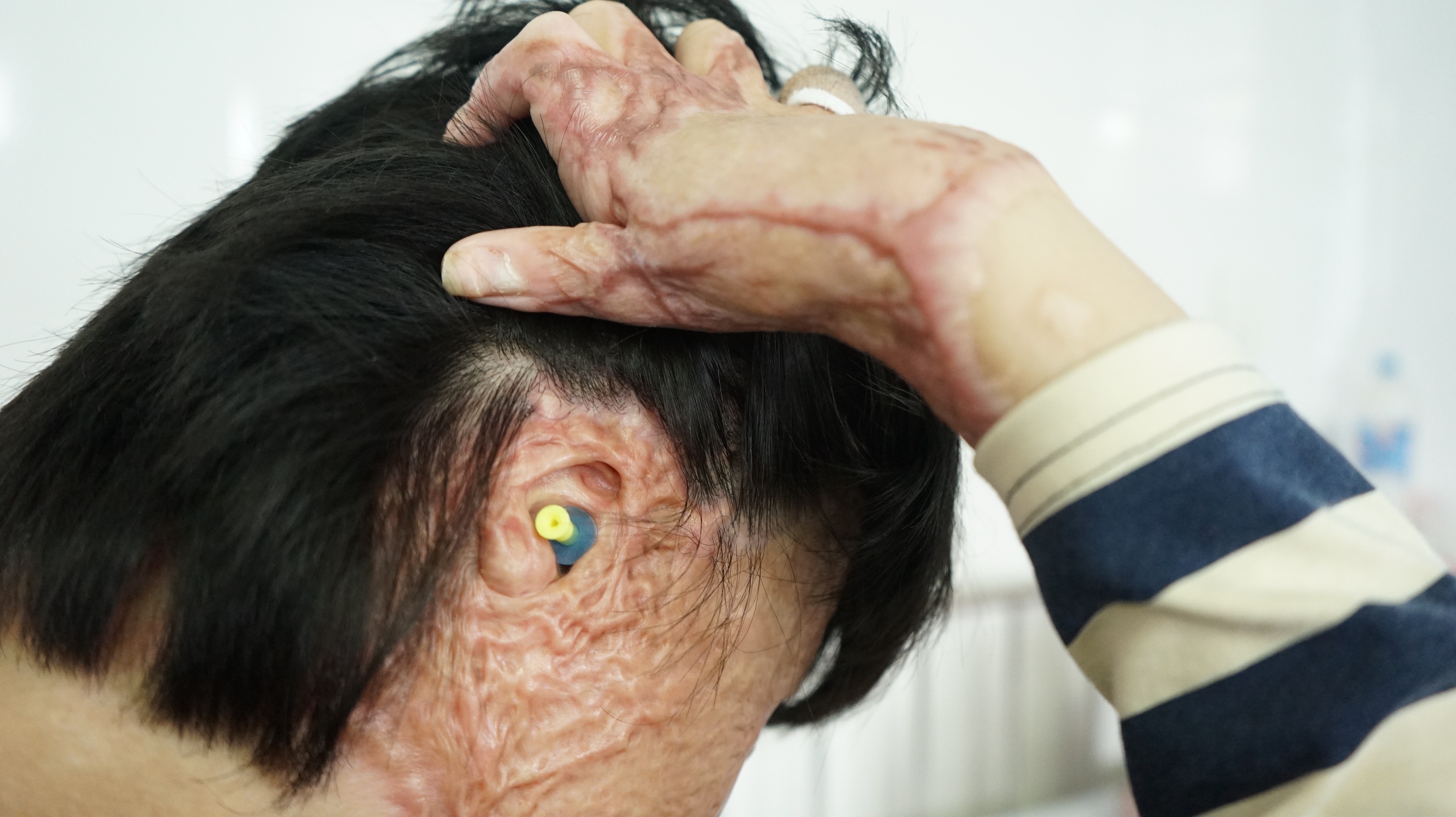 Co gai bi chong tuoi xang dot anh 3